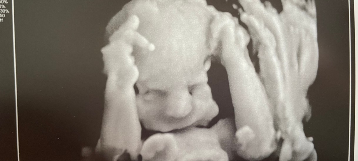 Pregnancy Story Alert!