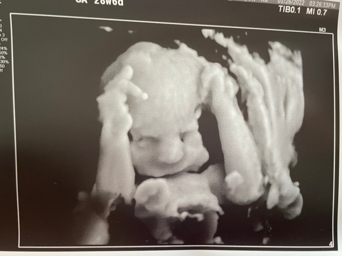 Pregnancy Story Alert!